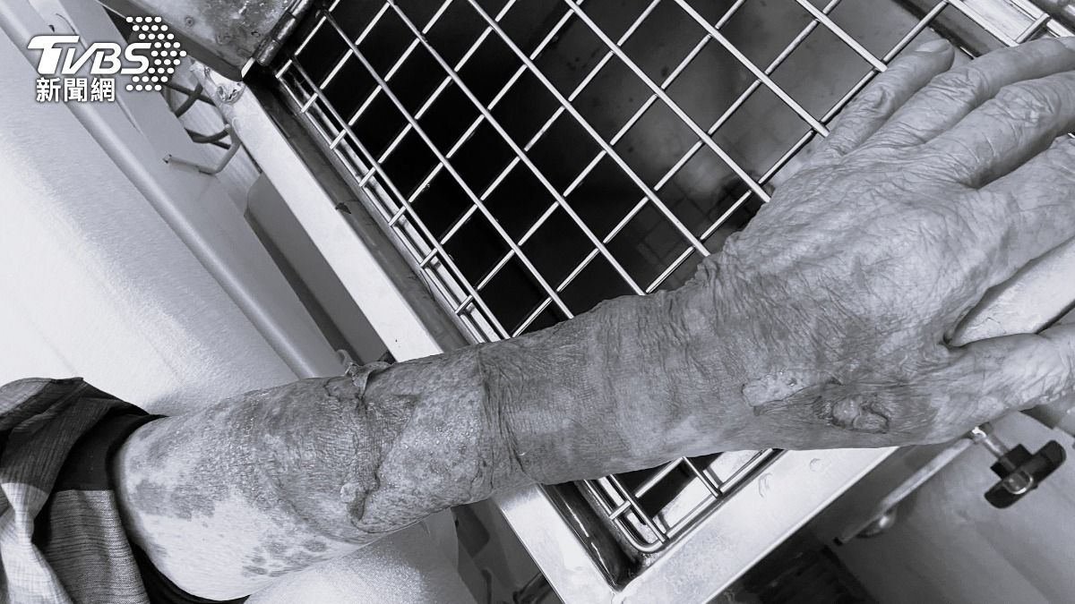 台中阿伯開車疑未打方向燈遭騎士怒揍 他血肉模糊傷勢超嚇人