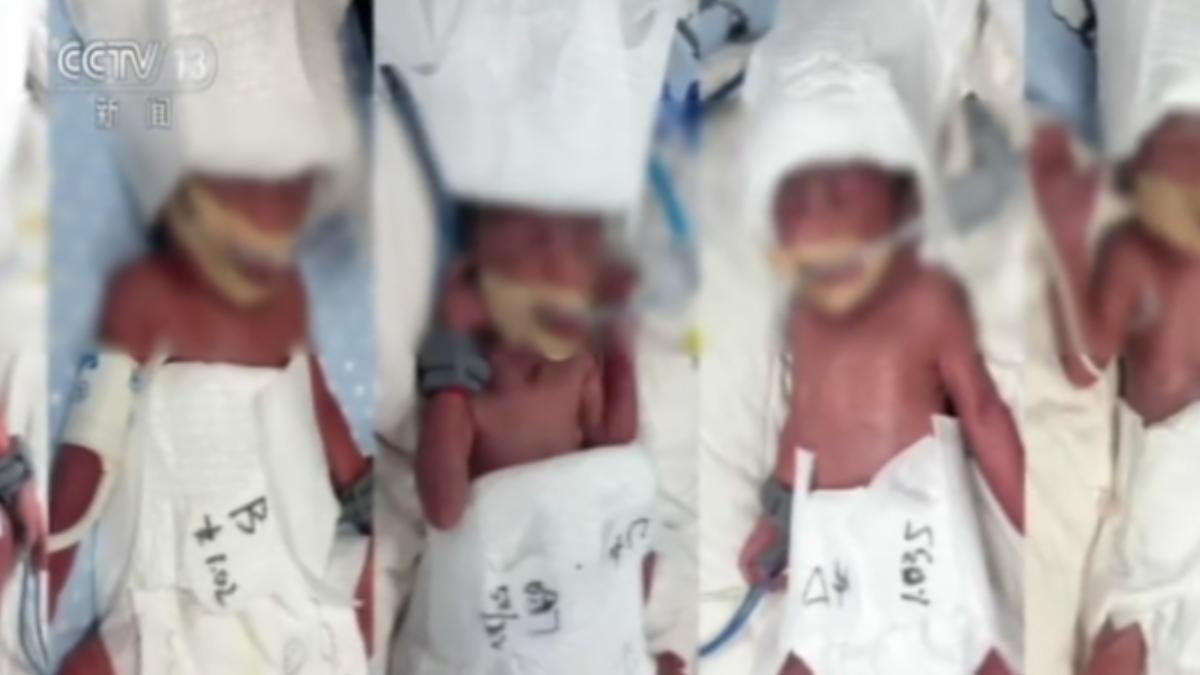 陸24歲產婦剖腹產五胞胎!1男4女母子均安 機率僅6千萬分之一│TVBS新聞網
