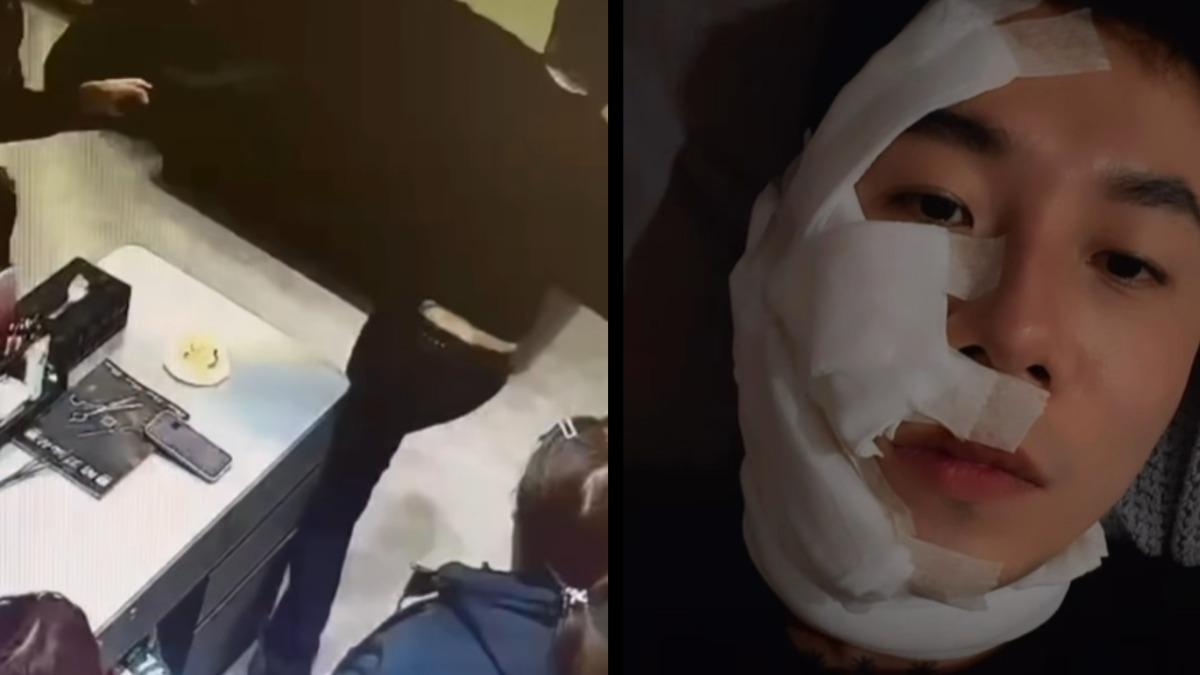 網紅美髮師「一生叔叔」出事!遭客潑辣椒水、毆打 腫臉慘況曝