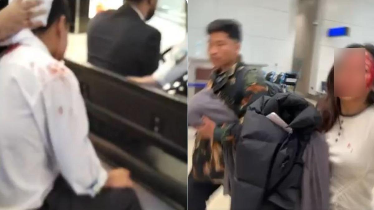 有片/杜拜機場遭伊朗自殺無人機襲擊 女滿臉血奔離畫面曝