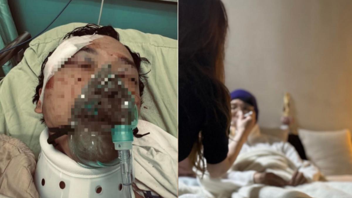 《豆腐媽媽》替身現況曝!未婚妻慟訴「右眼張不開」:民視在哪?