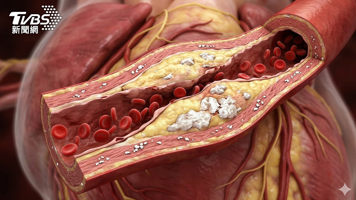 40歲後血管變骨頭?近八成人難倖免 恐心臟衰竭、認知退化