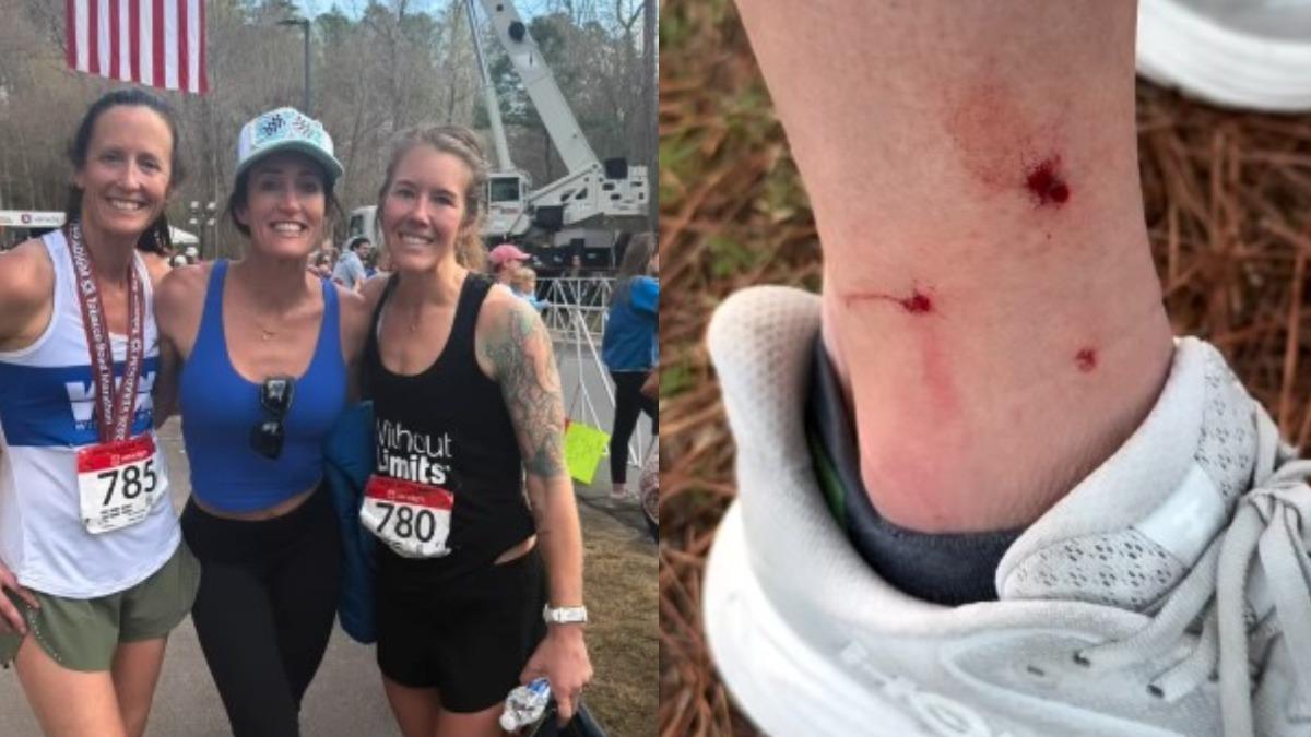 水獺也會攻擊人!女突遭牠狠咬流血 打7針狂犬病疫苗