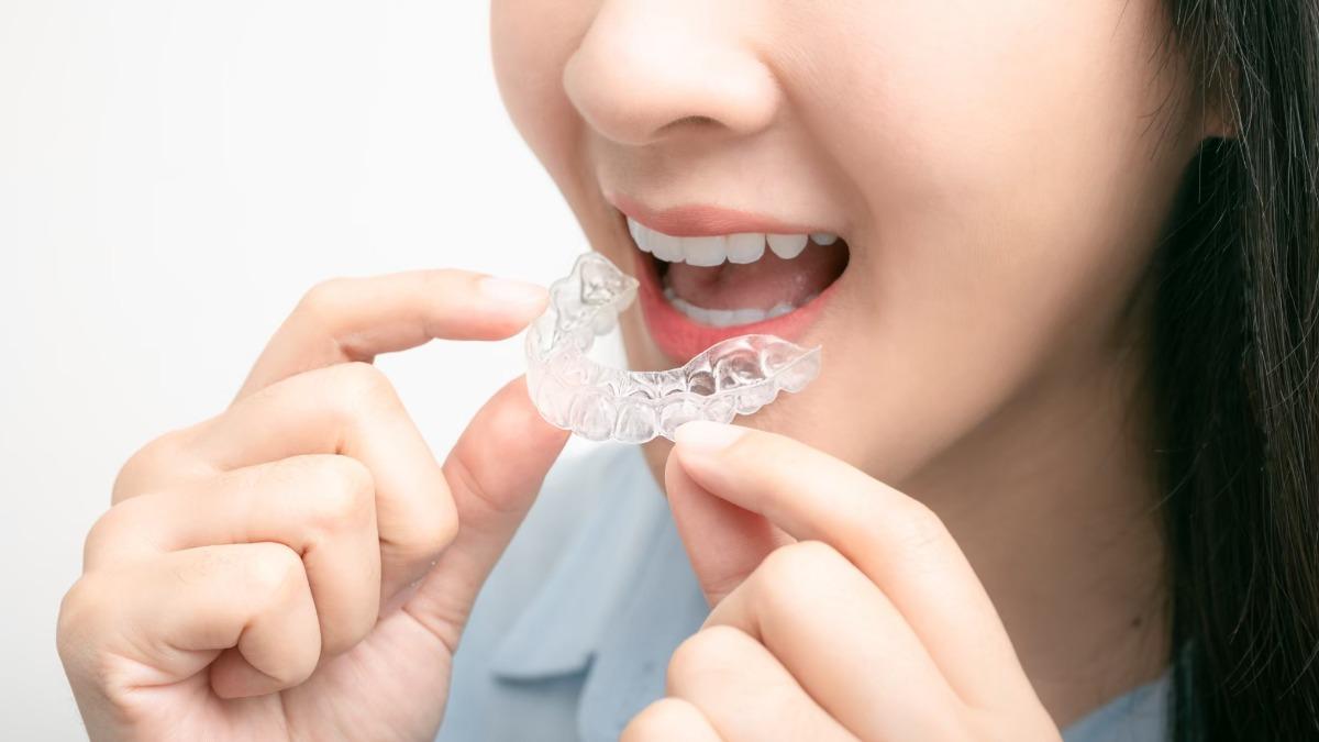 牙齒矯正後「牙縫竟跑出來」超醜!醫揭「黑三角」真相