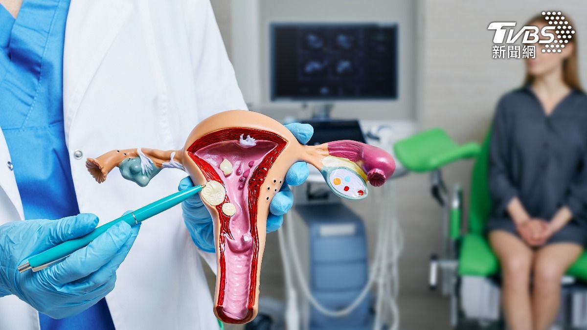 手術後能喝咖啡?醫揭「驚人奇效」助恢復 1行為婦科必做