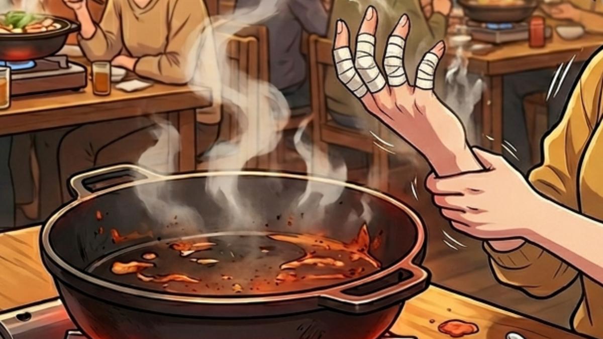 轟店員慢半拍!他到宜蘭知名鍋物用餐「4指燙傷紅腫」 業者道歉了