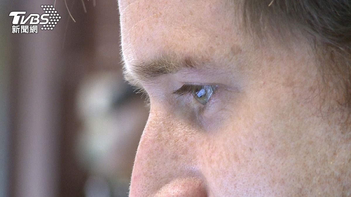 眼睛顏色藏健康密碼？醫師解析虹膜變化與疾病風險關聯