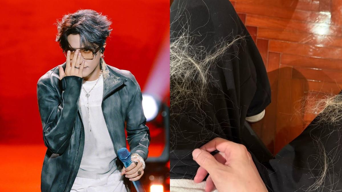 薛之謙漂髮遭灼傷!「滿頭水泡、鬼剃頭」照片曝 硬挺一週不洗頭