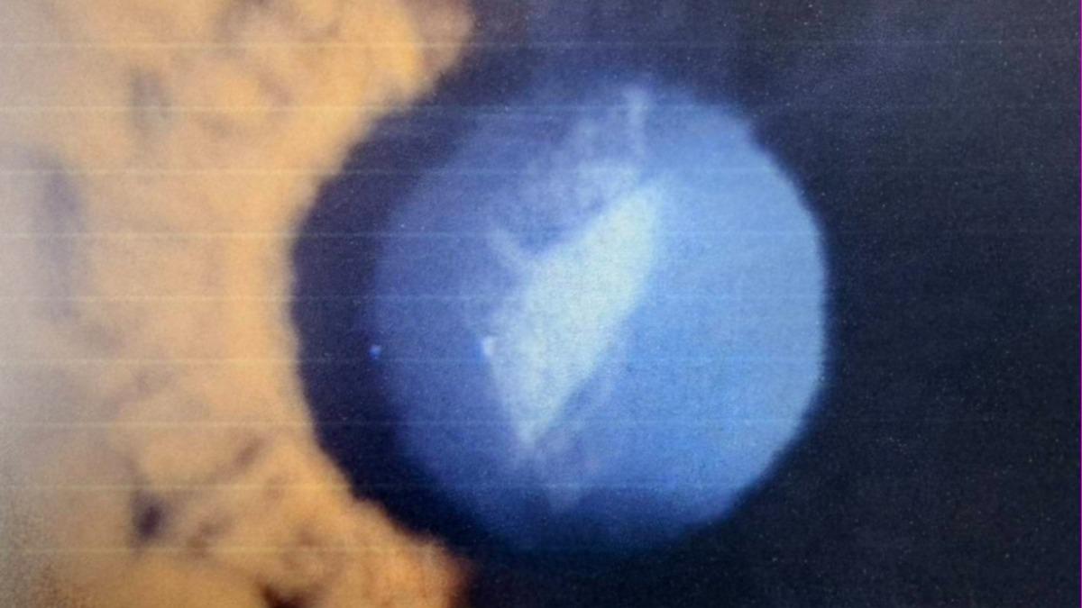 視力模糊、失去立體感以為是老化 醫簡單三招預防白內障