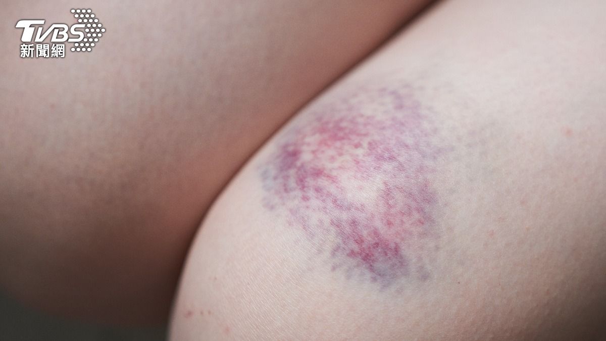 11小時奪命!女下體滲血、現紫斑 男友訴「我沒有」家屬不信惹鼻酸