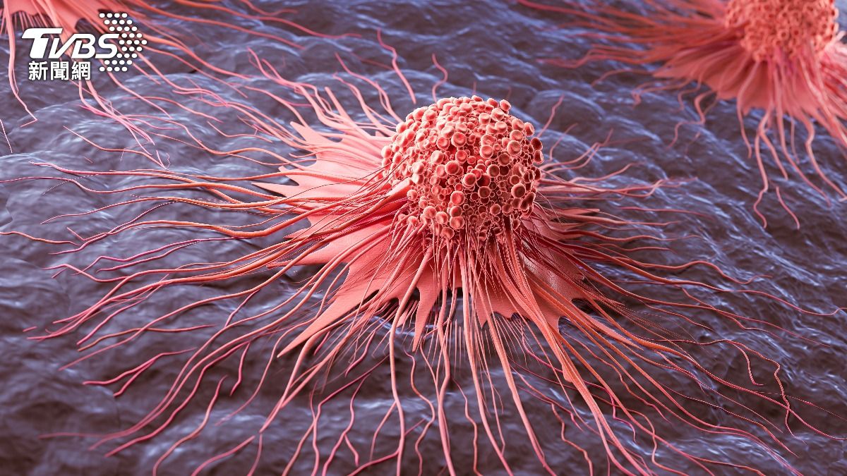 癌症重大突破!揪出1關鍵「癌細胞恐凋亡」