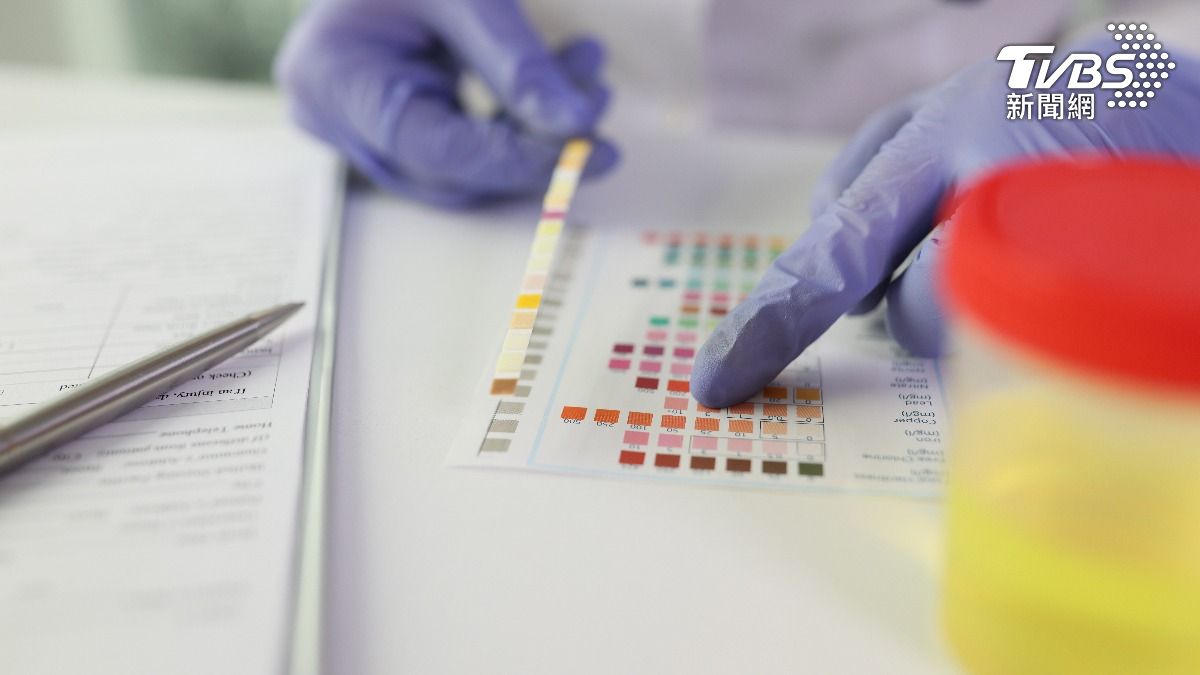 尿液有泡泡別著急!醫揭「顏色警訊」:這色恐是腫瘤