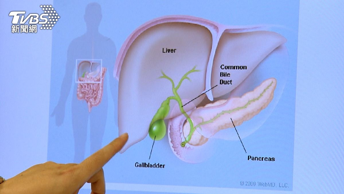 台灣每3人就有1人脂肪肝!醫示警:不只傷肝 心血管風險也上升