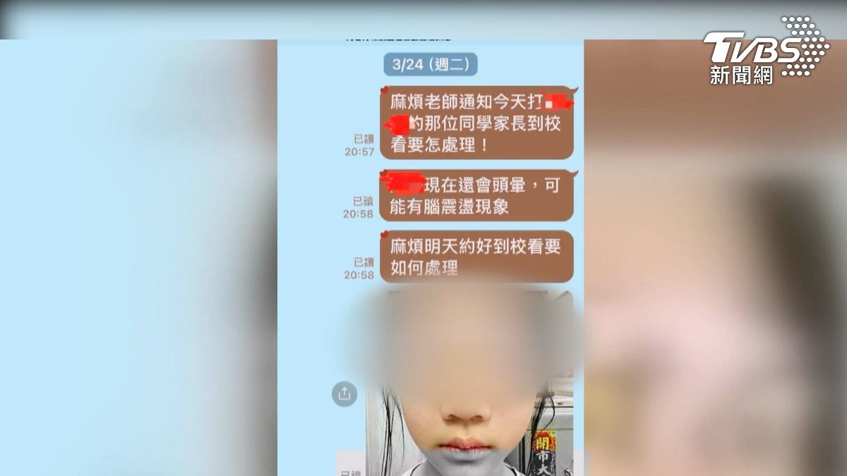獨/小四女童被同學球砸頭! 母控:又遭老師霸凌