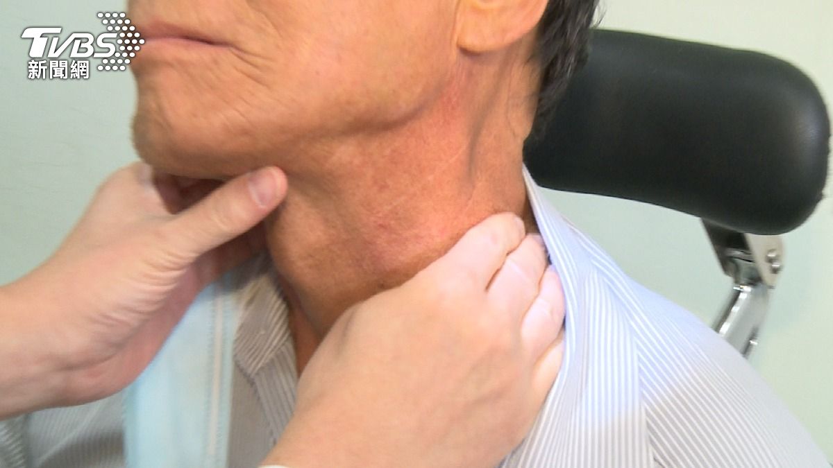 沒菸酒檳榔也會罹口咽癌!? 醫揭HPV感染「關鍵風險」是「這件事」!