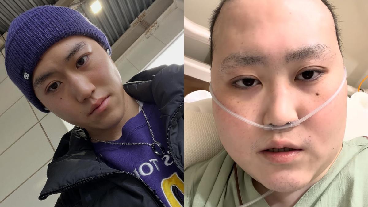 百萬分之一機率!21歲YTR罹罕病「骨肉瘤」抗癌4年過世 家屬心碎證實
