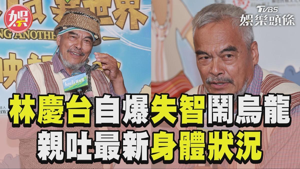 影音/林慶台「自爆失智」鬧烏龍 揭「身體狀況」:記憶力變差