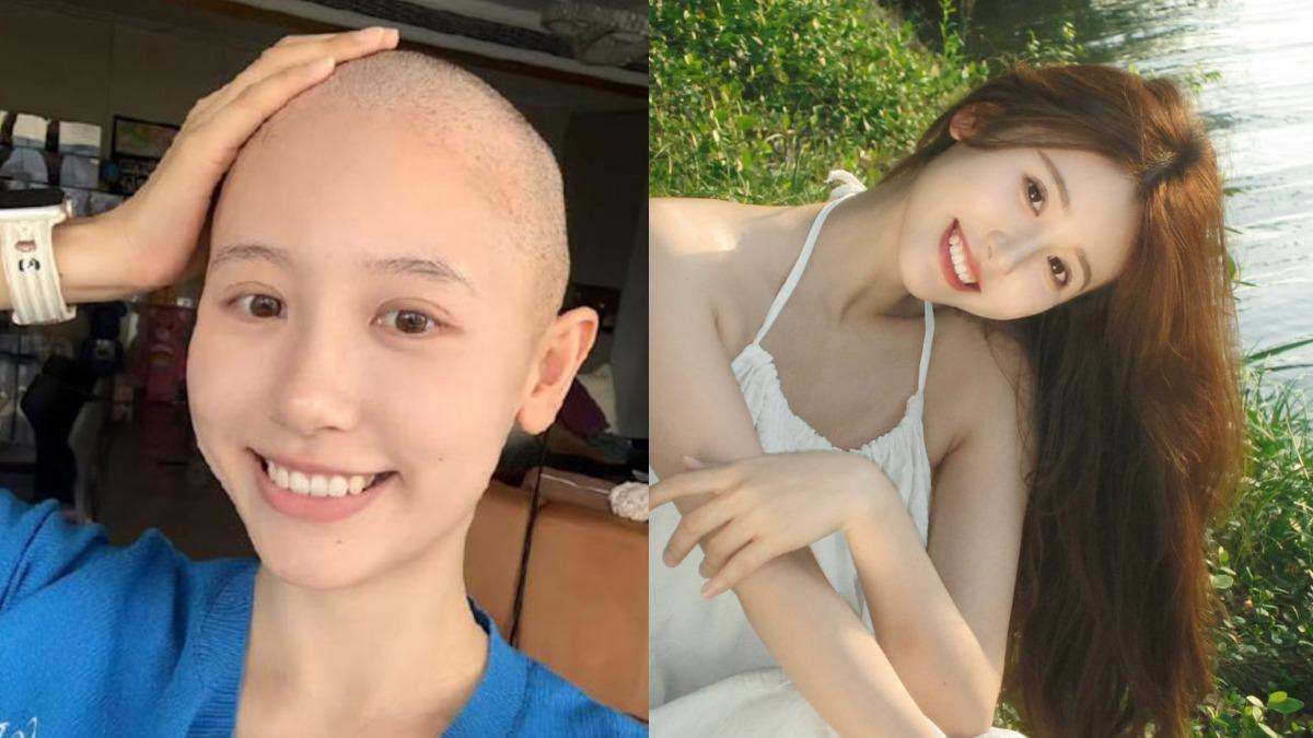 連咳2個月罹淋巴癌!千萬網紅剃頭抗12次化療 醫曝:初期像感冒