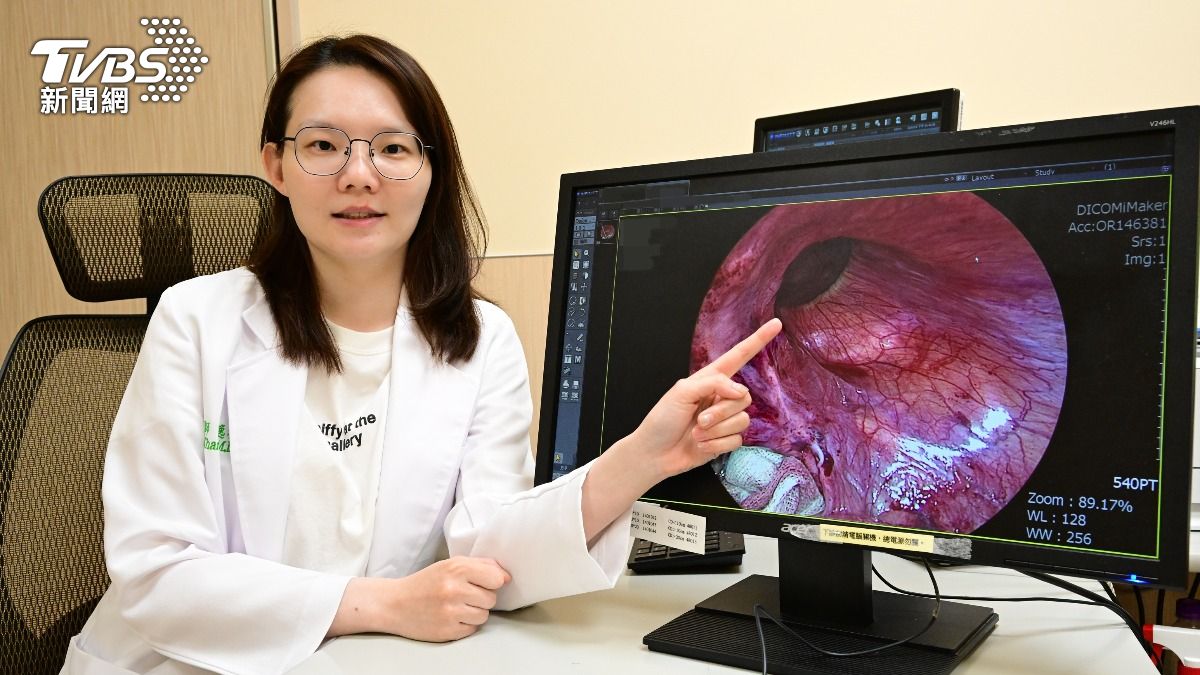 運將腹股溝驚見「大芒果」忍痛1年 醫驚:腸卡住差點壞死