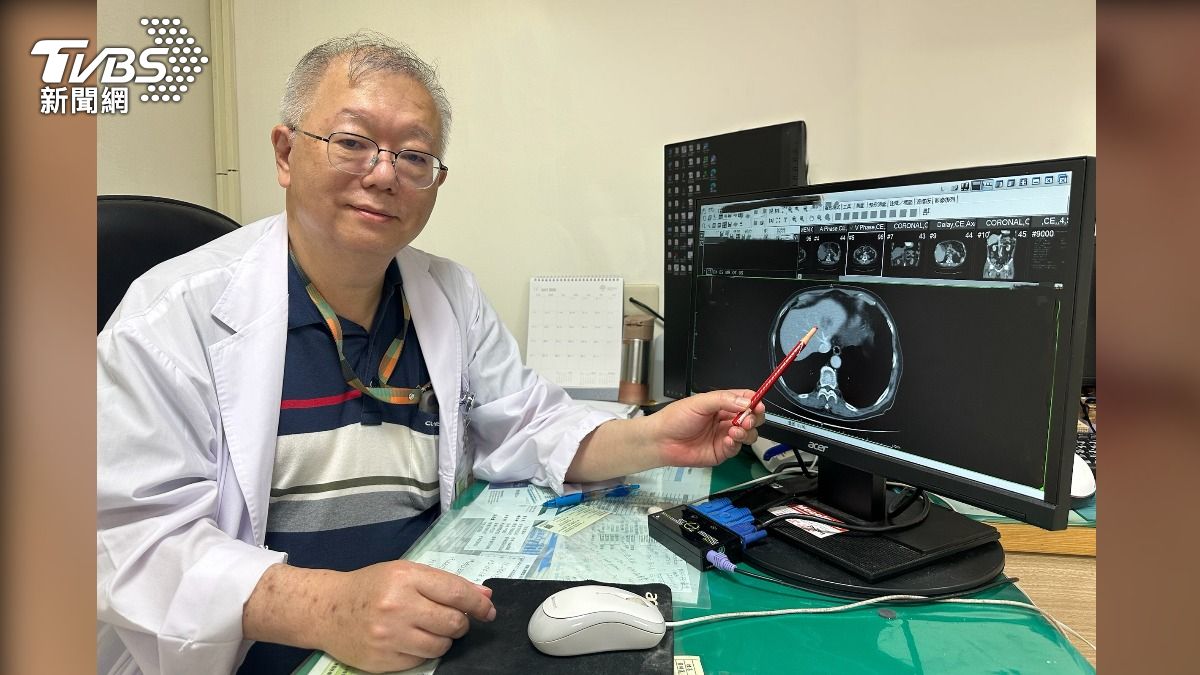 台中婦腹痛休克一查竟是「肝癌腫瘤破裂出血」 緊急手術救回