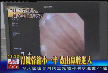 【徹底調査】 胃 全 摘 した 芸能人 ファン必見の最新情報 #685