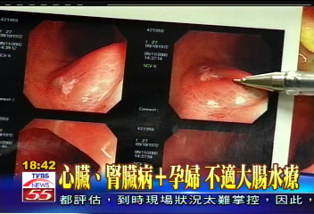 〈獨家〉遊走法律! DIY水療機直銷會直擊