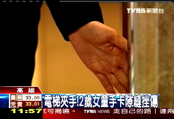 電梯夾手! 2歲女童手卡隙縫挫傷