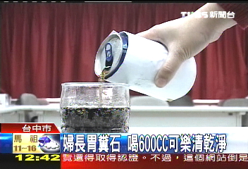 婦長胃糞石 喝600C.C.可樂清乾淨