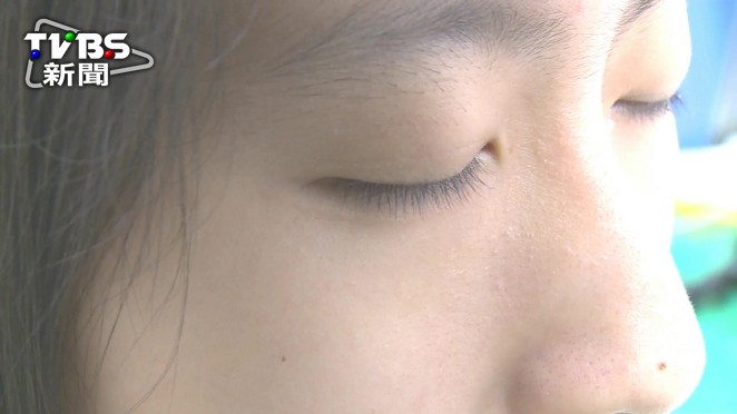 睫毛長遮住眼瞼護理師不知閉眼不全 乾眼症 假睫毛 兔眼 Tvbs新聞網