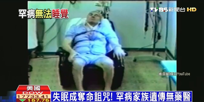失眠成奪命詛咒罕病家族遺傳無藥醫 致死 罕見疾病 家族性遺傳 治療 致死性家族失眠症 Ffi 醫學 醫療 Tvbs新聞網