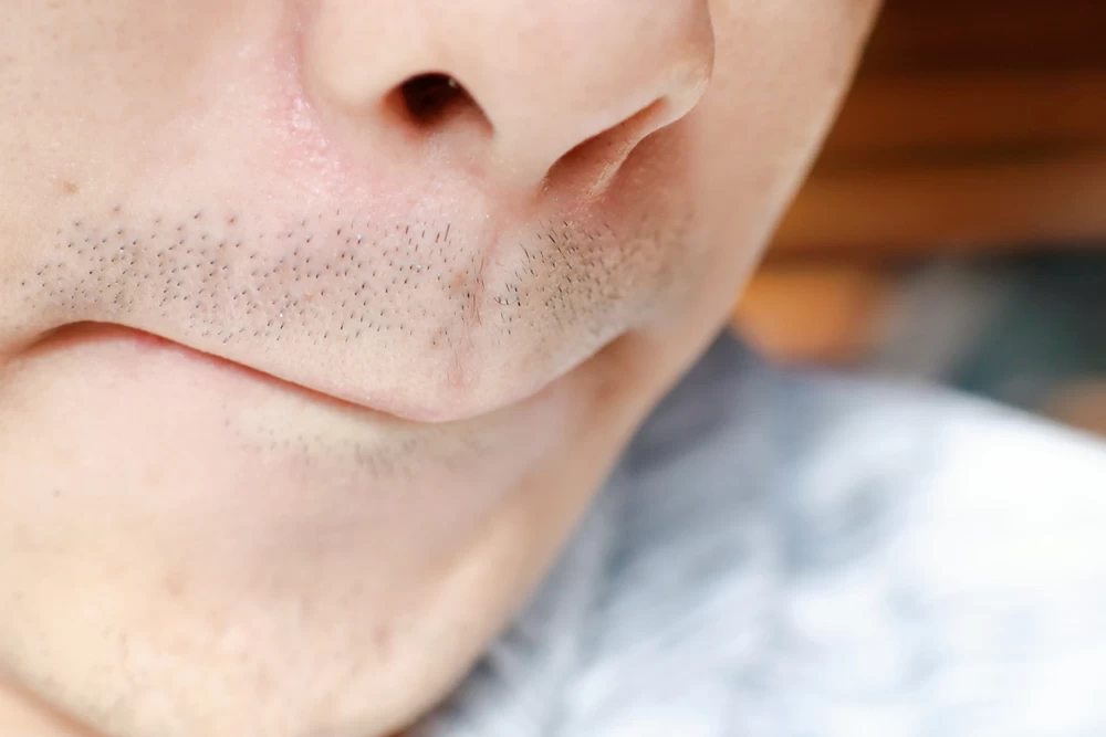 分手後無情男性面相特徵2.薄唇