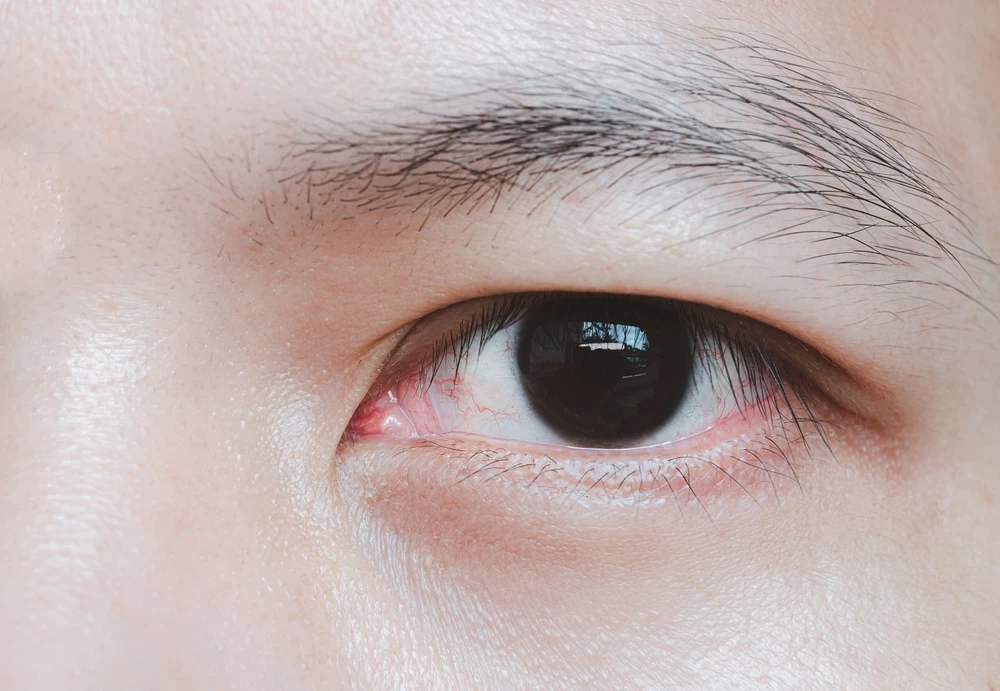 分手後無情男性面相特徵5.眉毛稀疏