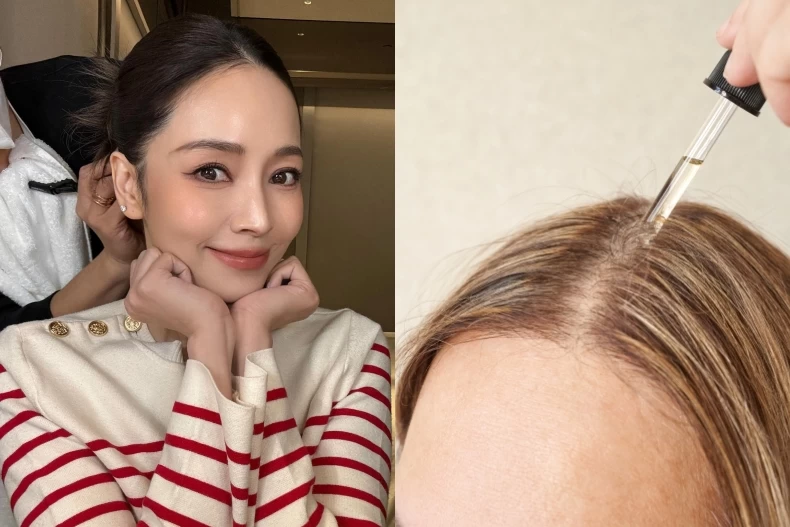 女神崩壞？47歲侯佩岑「髮際線驚悚後退」專家列髮際線養護3招神技！