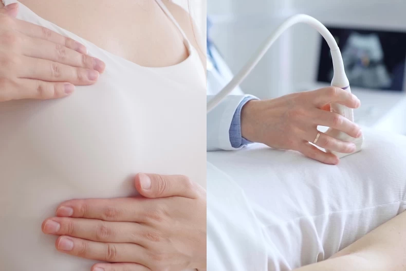 35歲乳房外科女醫罹「地表最兇乳癌」！點名「這習慣」害她差點沒命、90%人常忽略