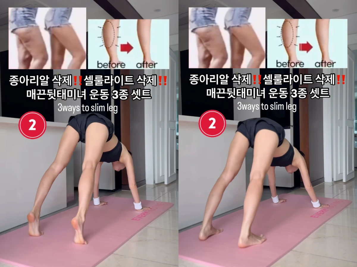 瘦小腿