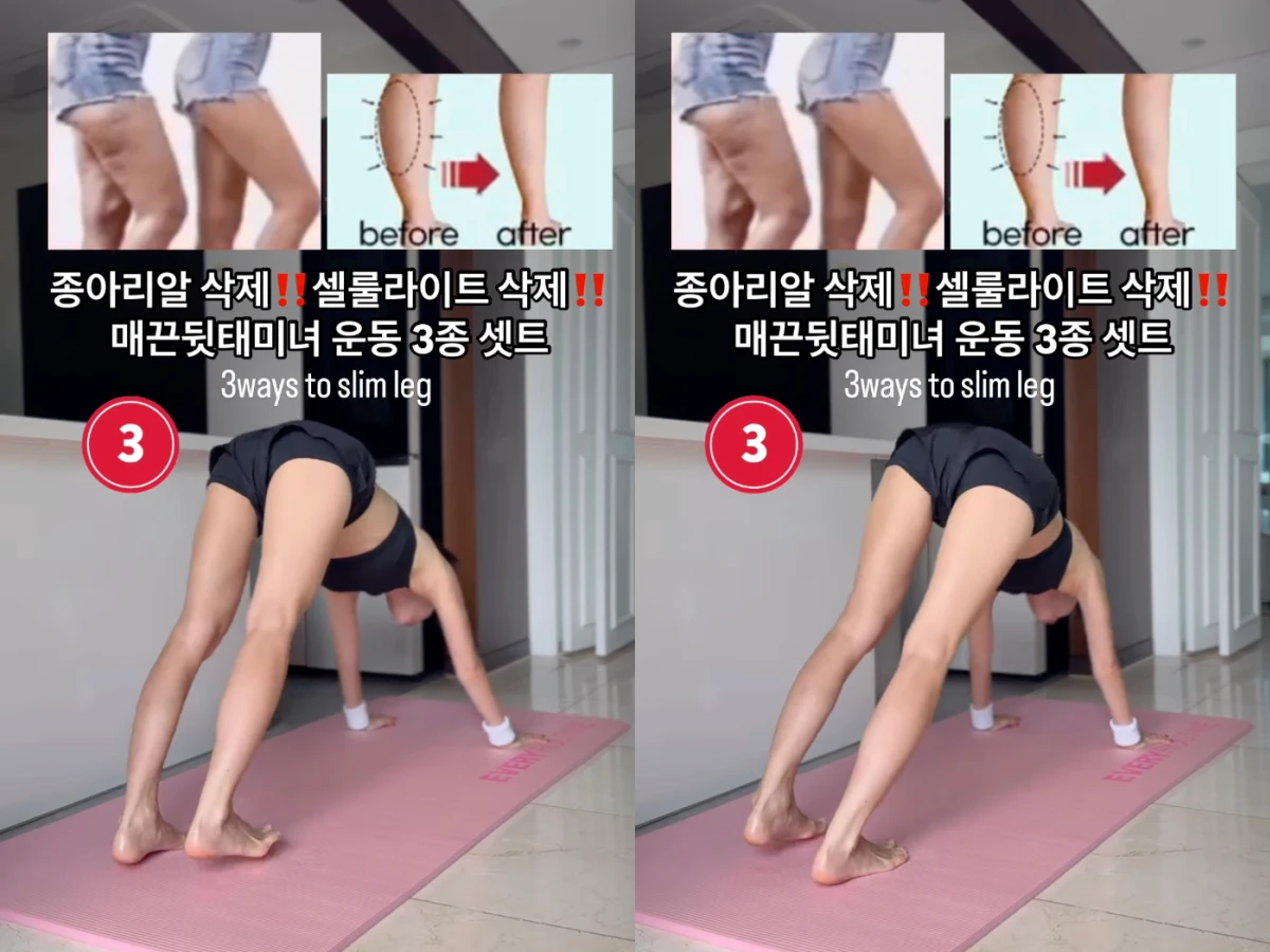 瘦小腿