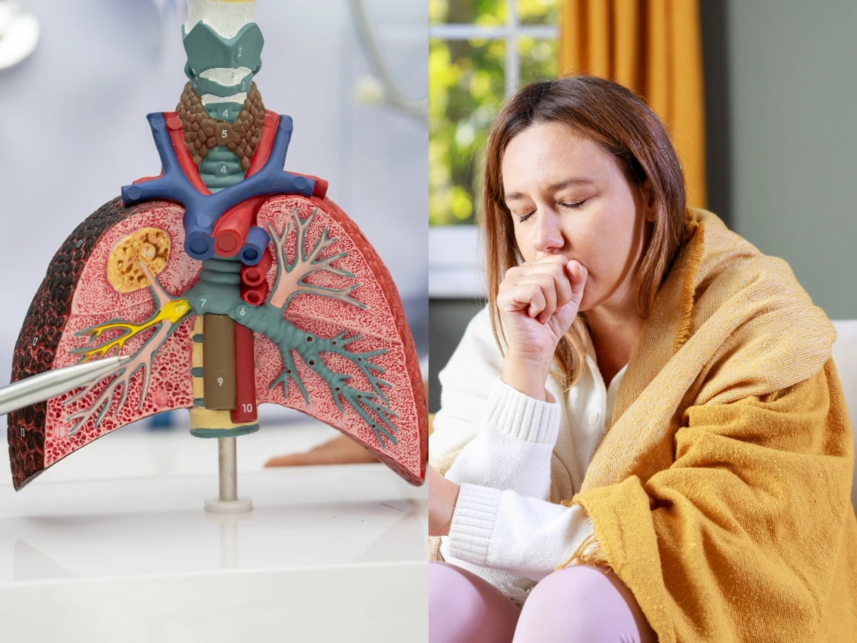 59歲坣娜驚傳肺腺癌病逝！專家揭台灣女性不菸不酒卻因「1習慣」成致癌元兇