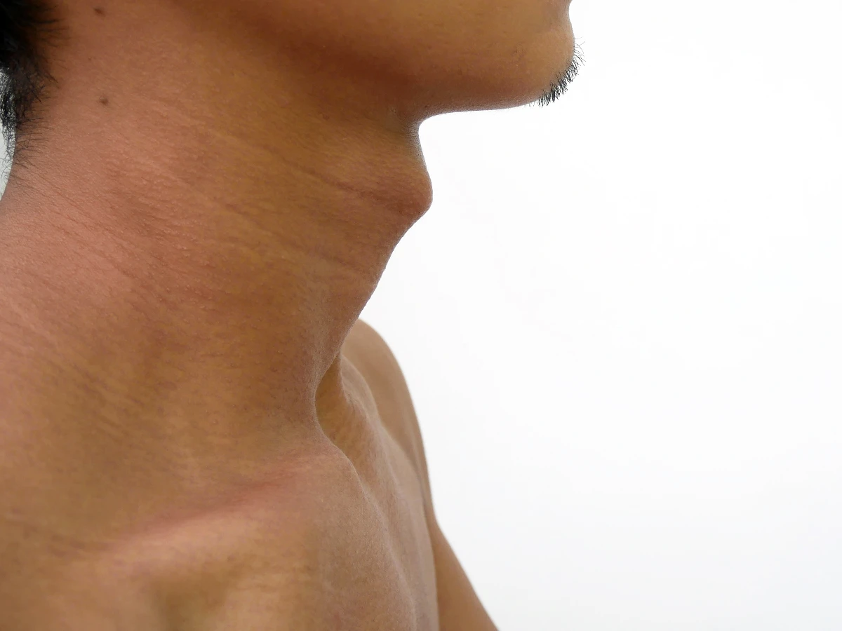 男人性能力面相特徵4.喉結大