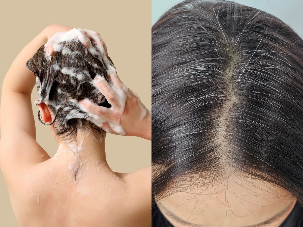 白髮能變黑？醫師揭密驚人真相「只有這種白髮有救」！網傳按摩頭皮竟然沒用？