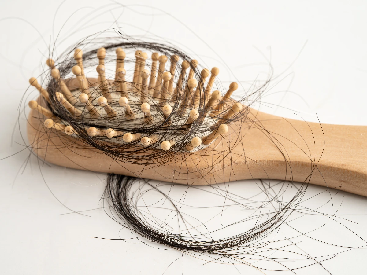 日掉過百條頭髮就要注意