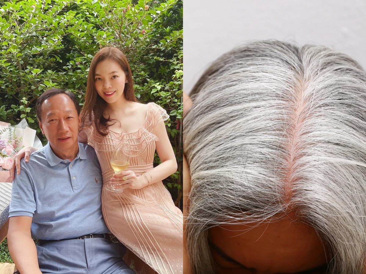 長白髮千萬別拔!1原因下場超慘,中醫親授「4大穴道+飲食」逆轉有感