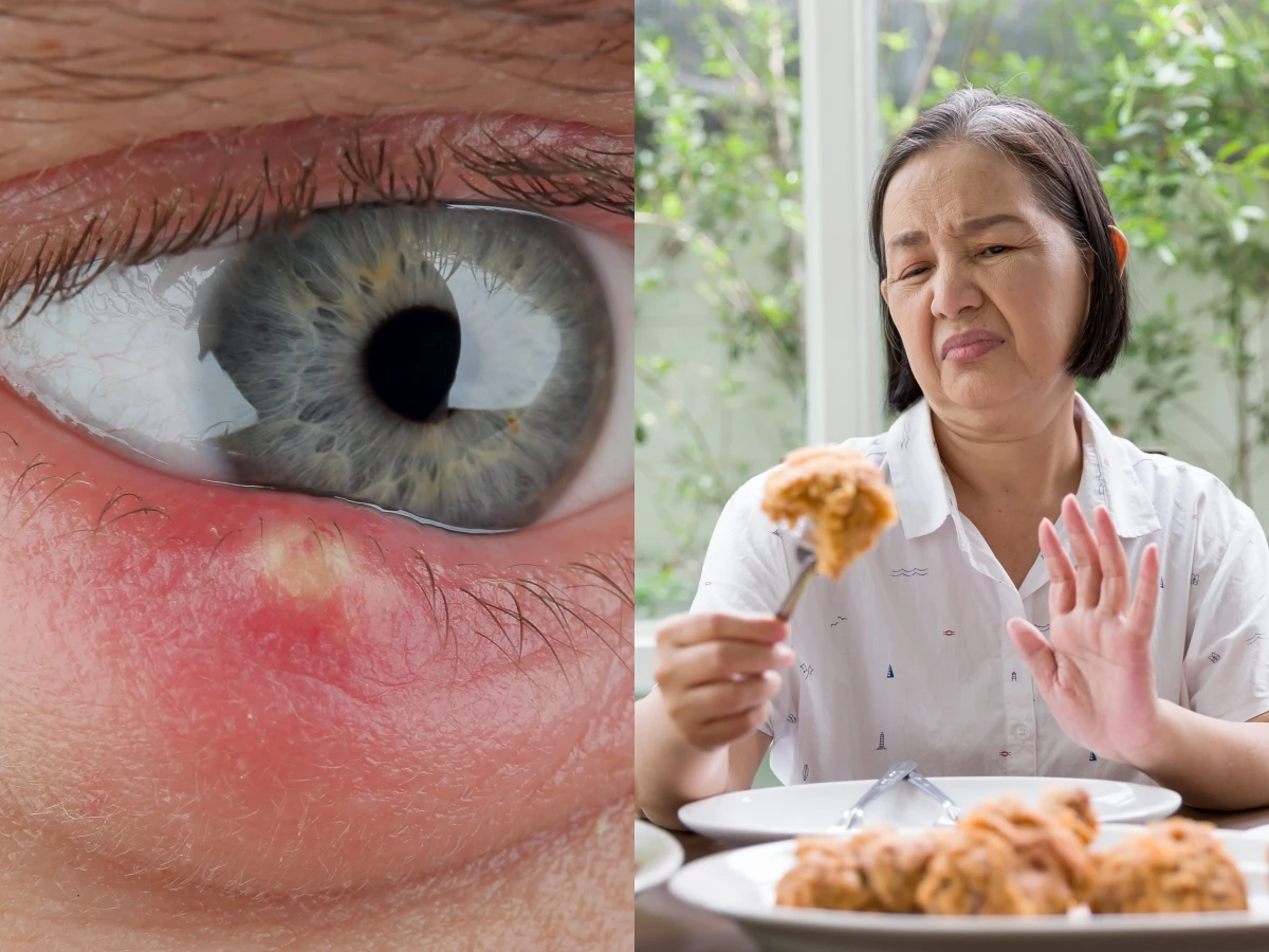 如何預防長針眼？5個你每天都做得到的習慣