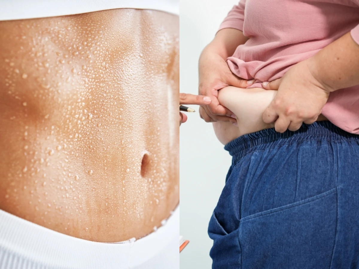 都是體內濕氣害你胖！4招身體除濕方法公開，戒3物臉、身體消腫一圈有感