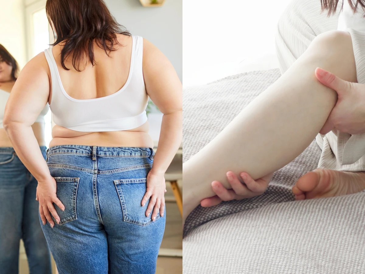 冬天一到就腫？原來是體內濕氣害的！紅豆＋1食物，腿真的細一圈