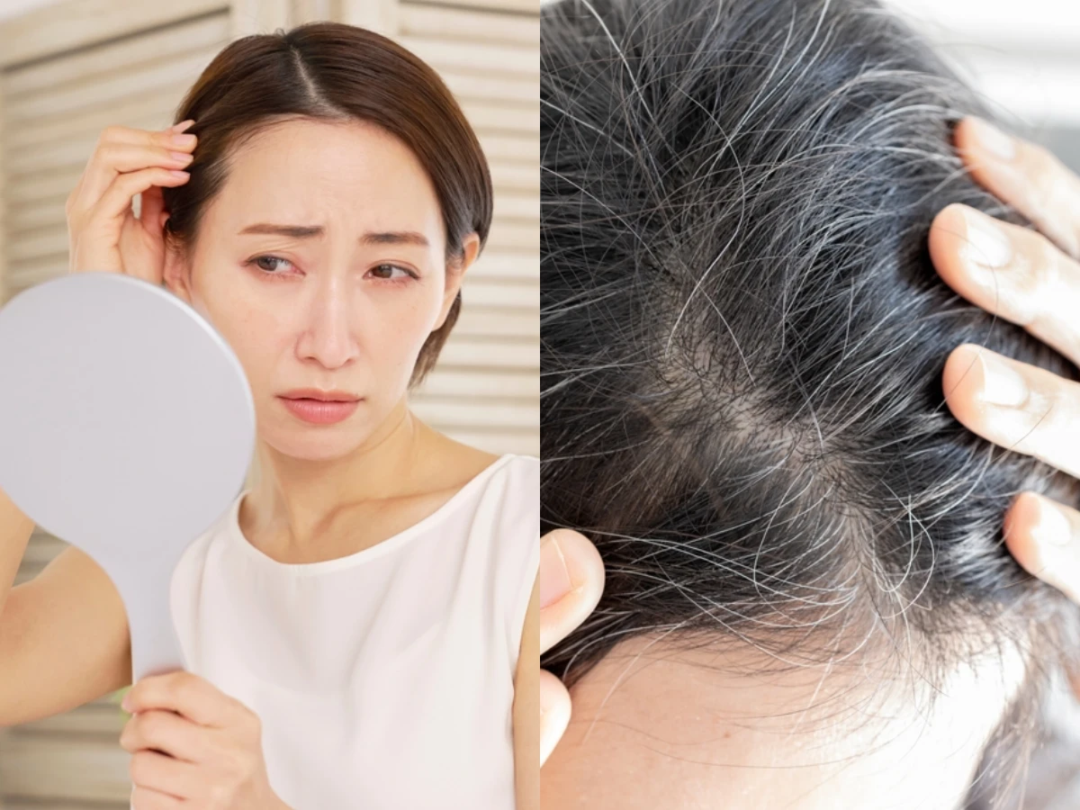 白頭髮能不能拔？醫師警告「千萬別拔」：缺這4種營養，白髮會越來越多！