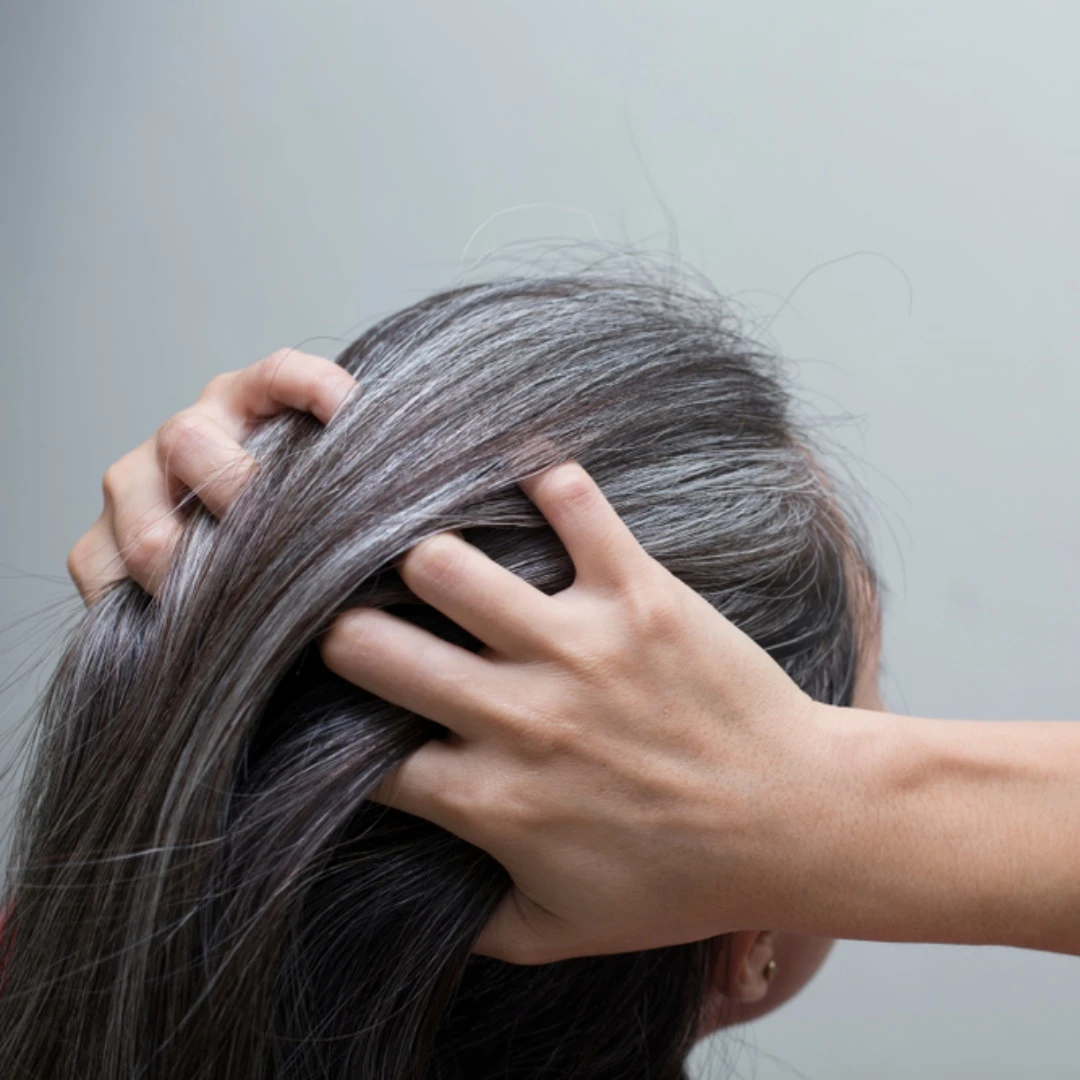 白頭髮會變回黑髮嗎？醫師解析哪些白髮「還救得回來」，5個預防關鍵一次看