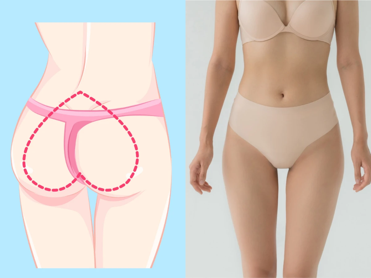 A型臀型：高腰三角褲