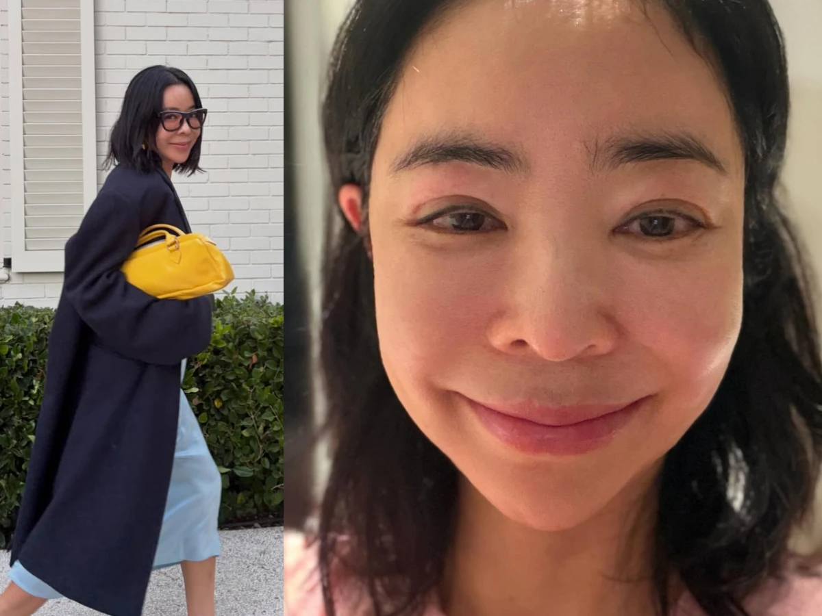 李惠英曬「臉部腫脹照」疑淋巴再出狀況嚇壞粉絲